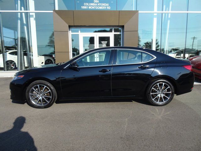 2017 Acura TLX V6 Advance