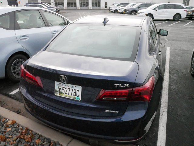 2017 Acura TLX V6 Advance