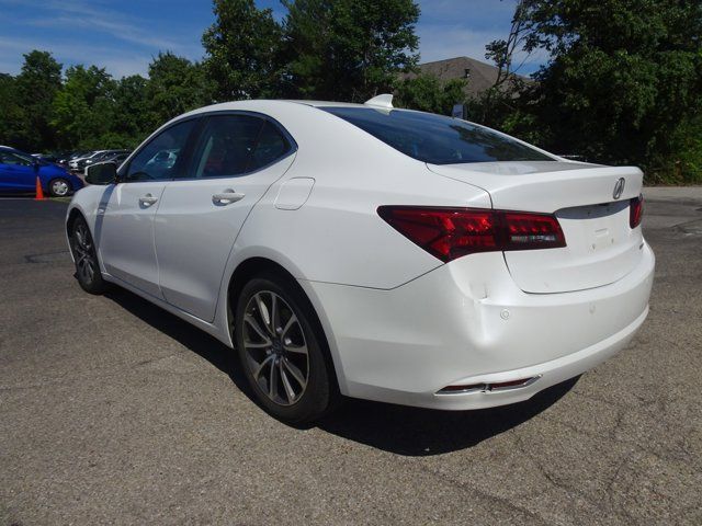 2017 Acura TLX V6 Advance