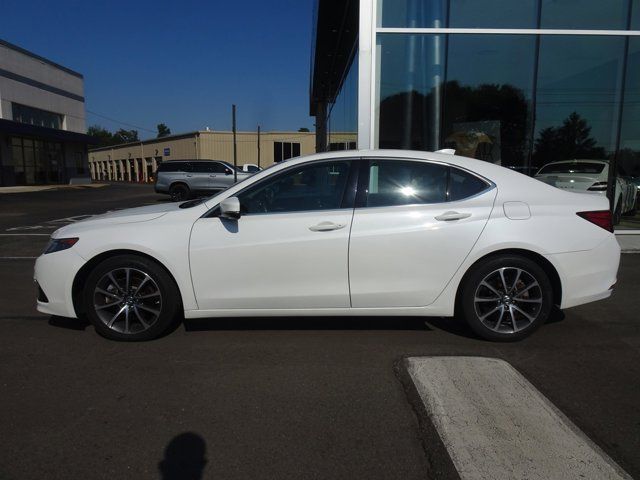 2017 Acura TLX V6 Advance