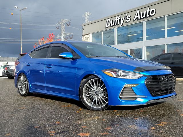 2017 Hyundai Elantra Sport