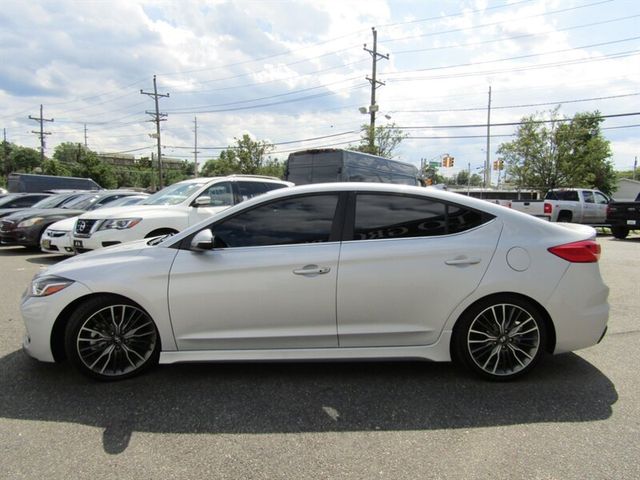 2017 Hyundai Elantra Sport