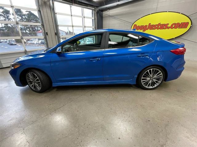 2017 Hyundai Elantra Sport