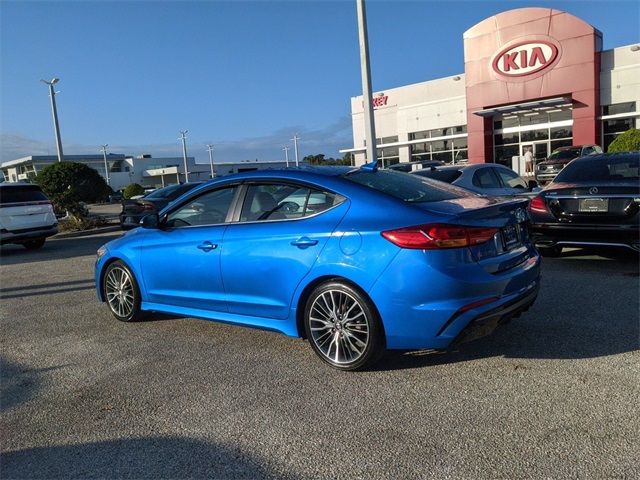 2017 Hyundai Elantra Sport