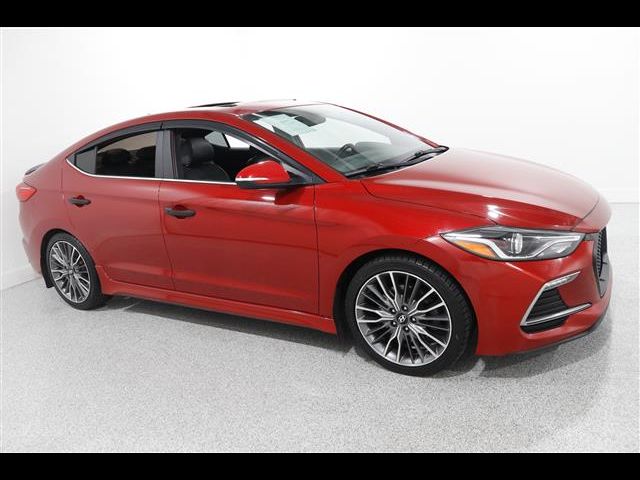 2017 Hyundai Elantra Sport