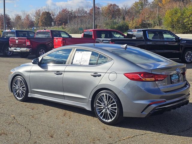 2017 Hyundai Elantra Sport