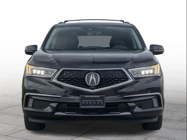 2018 Acura MDX Advance