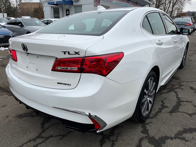 2018 Acura TLX Technology