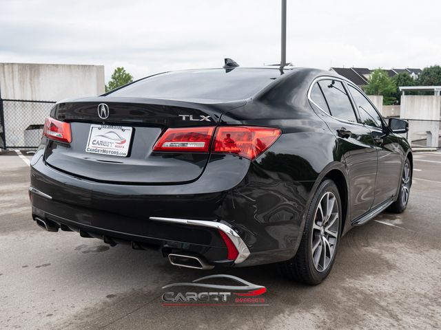 2018 Acura TLX Technology