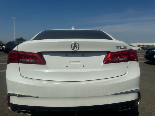 2018 Acura TLX Technology