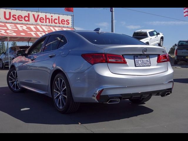 2018 Acura TLX Technology