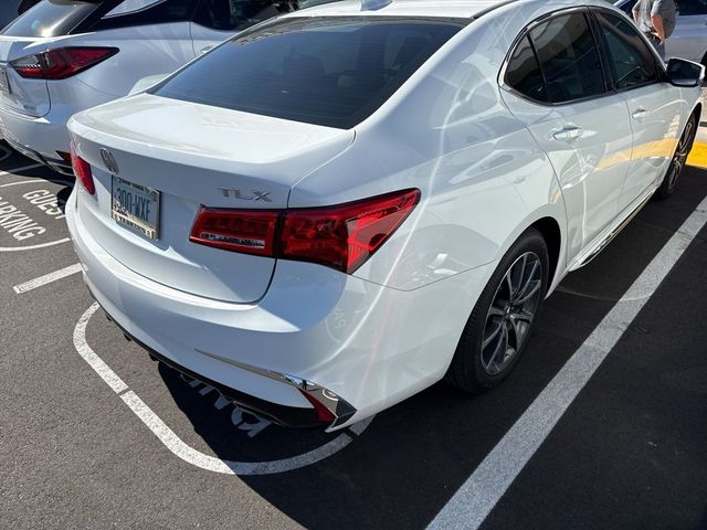 2018 Acura TLX Technology