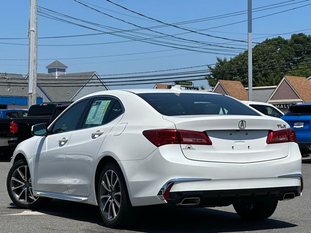 2018 Acura TLX Technology