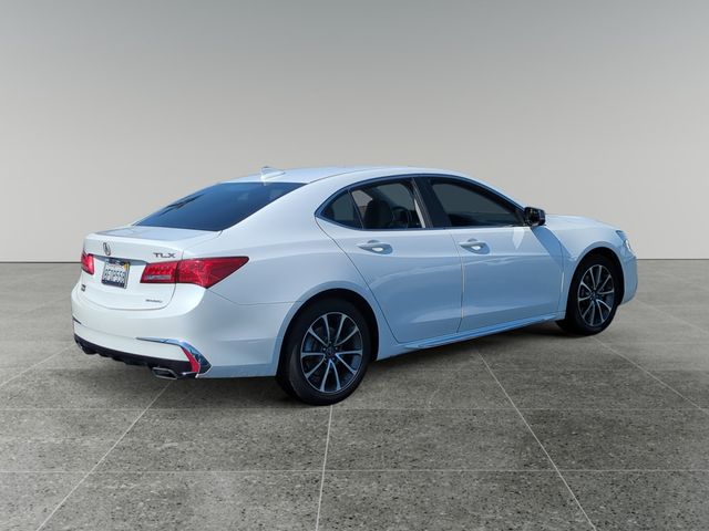 2018 Acura TLX Technology