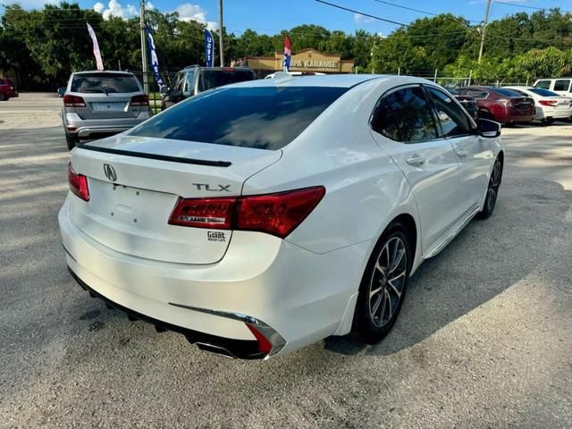 2018 Acura TLX Technology