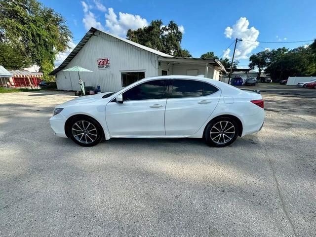 2018 Acura TLX Technology