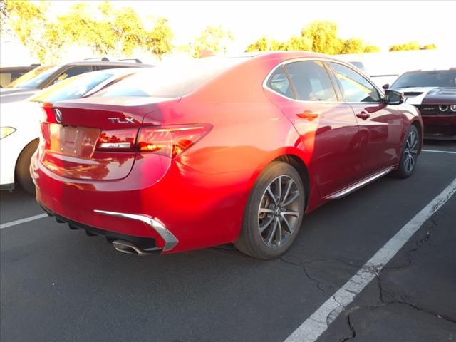 2018 Acura TLX Technology