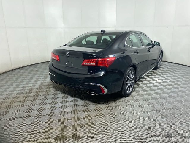 2018 Acura TLX Technology