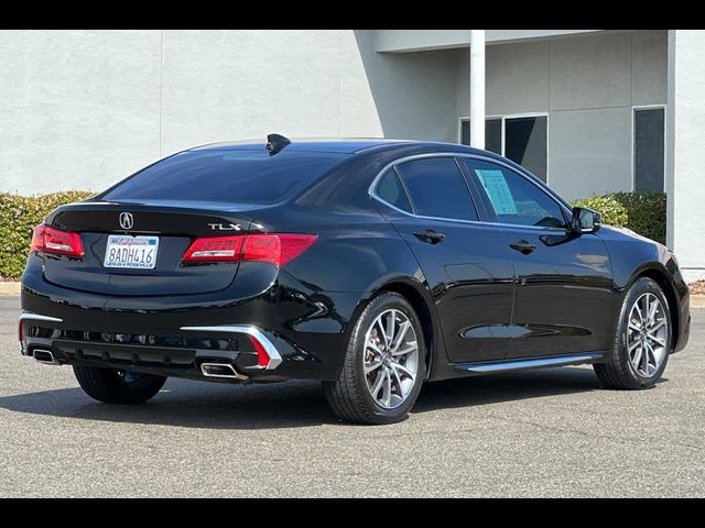 2018 Acura TLX Technology