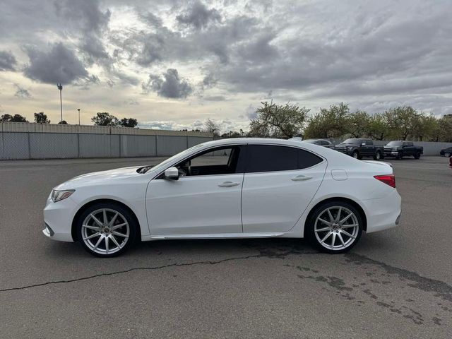 2018 Acura TLX Technology