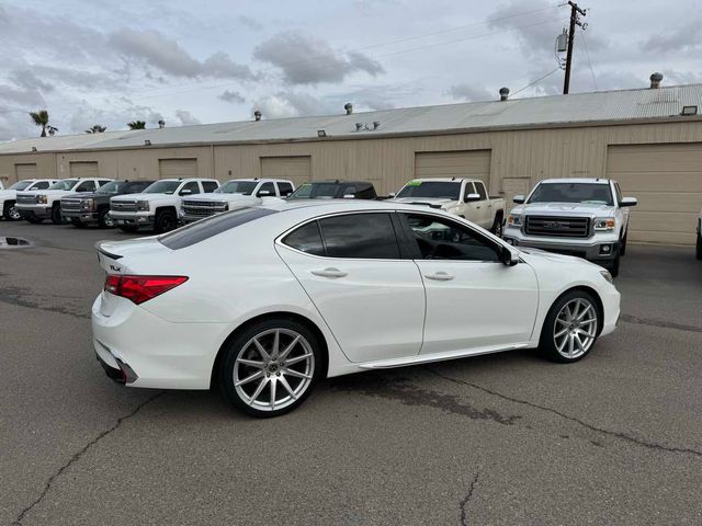 2018 Acura TLX Technology