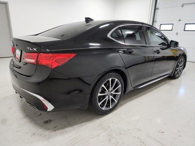 2018 Acura TLX Technology