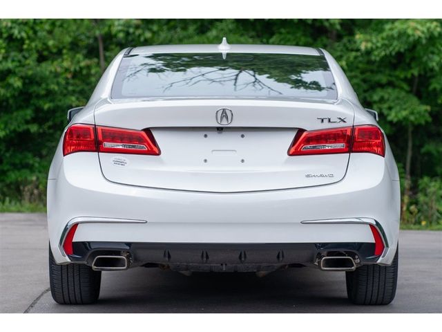 2018 Acura TLX Technology