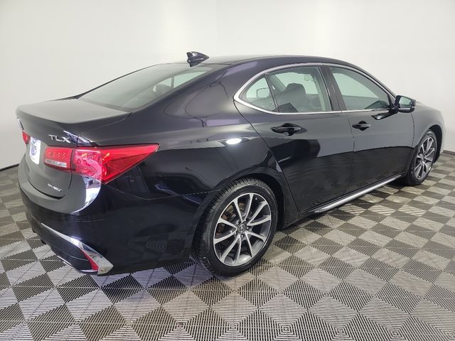 2018 Acura TLX Technology