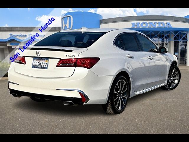 2018 Acura TLX Technology