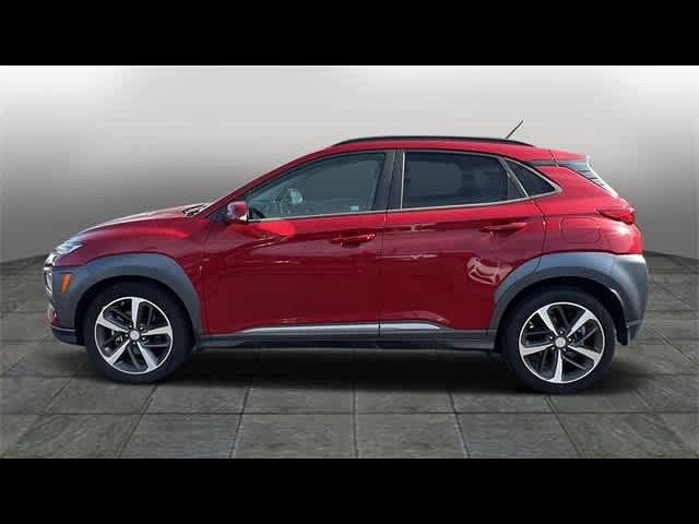 2018 Hyundai Kona Ultimate