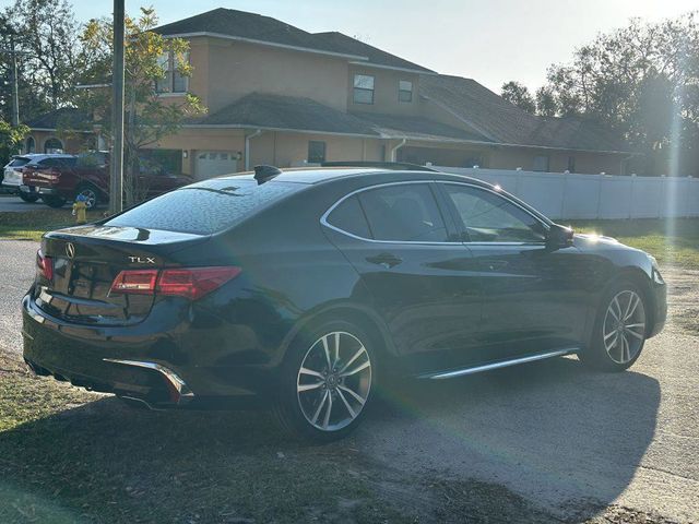 2019 Acura TLX Technology