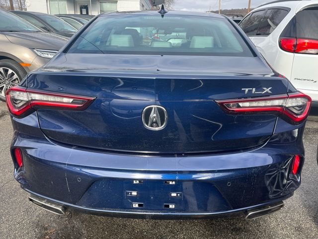 2021 Acura TLX Technology