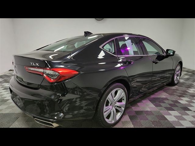 2021 Acura TLX Technology