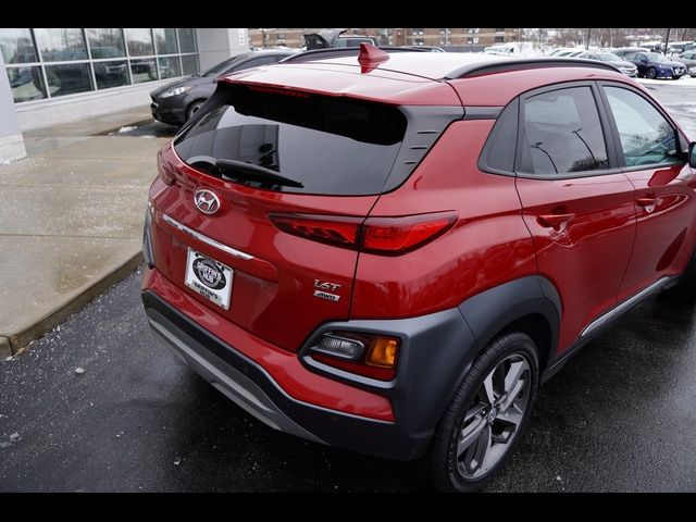 2021 Hyundai Kona Ultimate