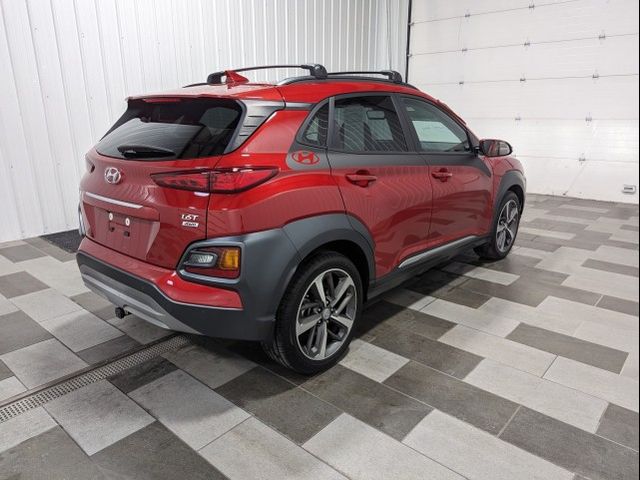 2021 Hyundai Kona Ultimate