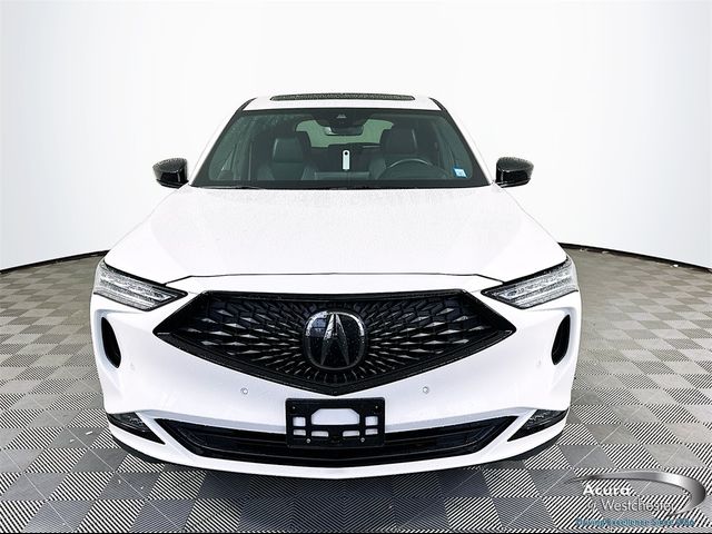 2022 Acura MDX A-Spec