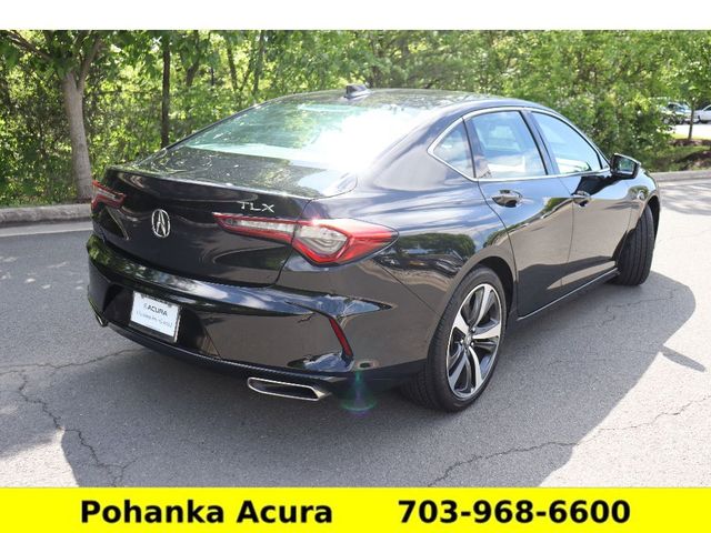 2025 Acura TLX Technology
